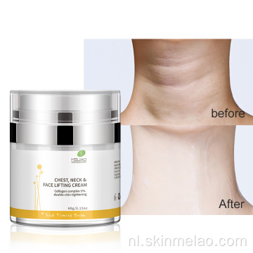 Verlichtingsverstakking Wrinkle Remover Dark Skin Neck Cream